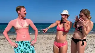 Embarrassing Sunburn Prank!