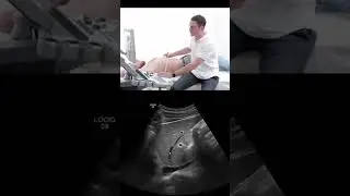 Key Structures in #liver #ultrasound #Shorts