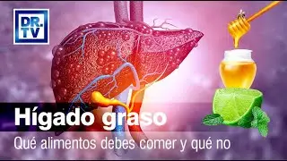 Fatty liver - What you should eat and what not
