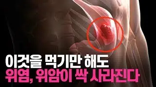 이 음식을 먹기만해도 위염이 싹 사라진다 위염에 좋은 천연치료제