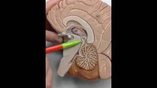 Commissures of brain
