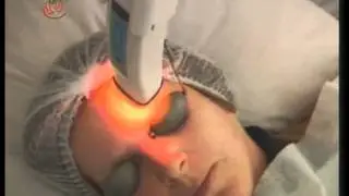 UPFTV Reportagem - Terapia Fotodinâmica