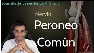 ECOGRAFIA NERVIOS MIEMBRO INFERIOR PARTE II: NERVIO PERONEO COMÚN
