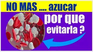 ¡Adiós azúcar! porque deberias dejarja  o reducirla a cero