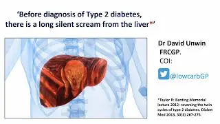 Dr. David Unwin - 'Before diagnosis of Type 2 diabetes there is a long silent scream from the liver'