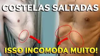 COSTELAS SALTADAS! Cirurgia de Pectus resolve a costela?