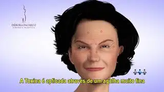 TOXINA BOTULÍNICA   - Dra. Débora Tomatis Pacheco - Cirurgia Plástica - Porto Alegre/RS
