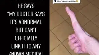 Awesome hands on TikTok duet #2