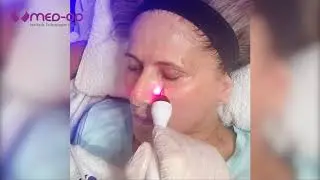 מכונת עיבוי שפתיים, מיצוק פנים, מיצוק צוואר - מד אופ אתסטיק