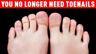 Future Body Mutations: The Evolution of Toeless Feet and Emerging Human Features