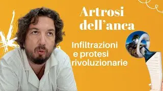 Artrosi dell'anca Infiltrazioni con piastrine, cellule staminali e Protesi