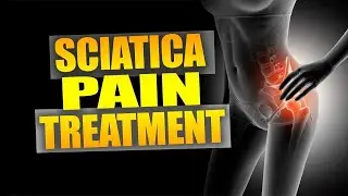 How to Cure Sciatica Permanently | Home Remedies for Sciatic Nerve Pain.
