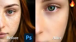 ✅How to Clean Face Black Spot in 1 Minute in Photoshop Tutorial🔥
