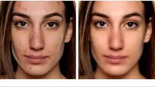 Como Retocar Una Fotografía En Photoshop
