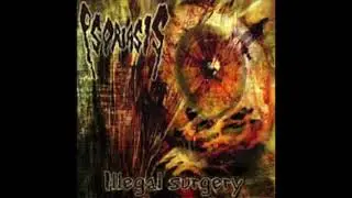 Psoriasis - Illegal Surgery (2004 Death Metal France)