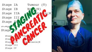 PANCREATIC CANCER STAGING (TNM and AJCC); basic understanding made easy