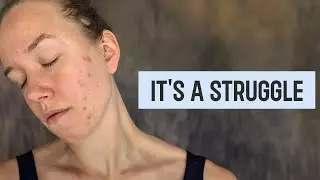 My Complicated Relationship With My Skin