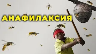 Анафилаксия (анафилактический шок) 