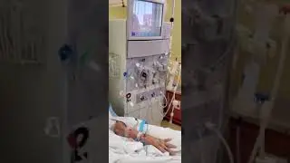 Hemodialysis Treatment Initiation with Arteriovenous Fistula