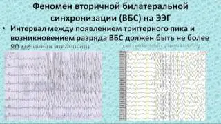 Диагностика ИГЭ и КФЭ