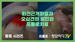 어깨통증의 차이와 치료방법_회전근개파열과 오십견_청담마디신경외과 심재현원장