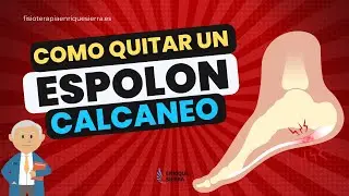 CÓMO QUITAR UN ESPOLÓN CALCÁNEO ✅ ONDAS DE CHOQUE