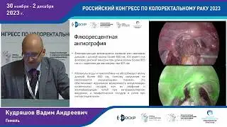 Опыт лапароскопических вмешательств при колоректальном раке