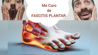 Cómo Curar la Fascitis Plantar🦶🏻👨🏻‍⚕️➡️MÉTODO 2