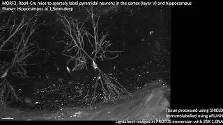 High-Resolution MORF3-labeled Hippocampal Neurons