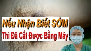 Dấu Hiệu Nhận Biết Hẹp Bao Quy Đầu Độ 1 Và Viêm Da Bao Quy Đầu | Bác Sĩ Sắc