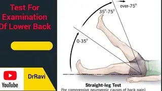 Test For Examination Of The Lower Back- Everything You Need To Know By DrRavi