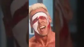 STING THEN AND NOW