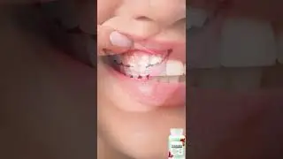 prodentim oral health supplement....