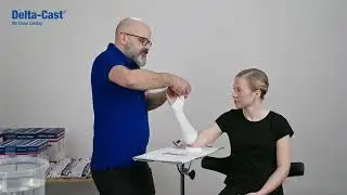 Delta Cast® Conformable Treatment of a Scaphoid Fracture without MCP Joint