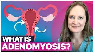 Adenomyosis EXPLAINED: Symptoms You Can't Ignore + Treatment Options