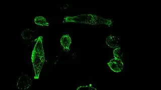 Lattice Light Sheet Microscope footage