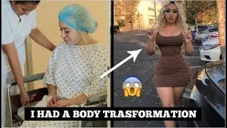MY SHOCKING RESULTS OF ROUND 2 BBL & BREAST AUGMENTATION
