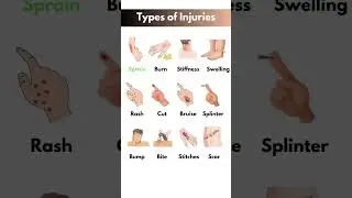 Injuries 