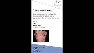Rejuvenecimiento facial
