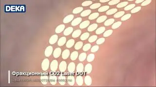 🧖 Лікування нетримання сечі у жінок лазером 💎Інноваційна методика MonaLisa Touch 💟