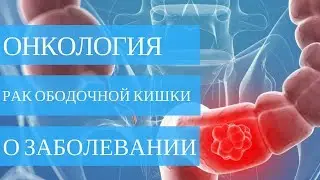 Рак ободочной кишки. КАК ЛЕЧИТЬ РАК?