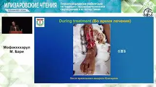 Илизаровские чтения   16 июня 2023   ПОСЛЕДСТВИЯ ТРАВМ ОПОРНО ДВИГАТЕЛЬНОЙ СИСТЕМЫ