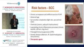 VII Workshop - K. Peris - Diagnosi e gestione pazienti con cheratosi attiniche e SCC - part 2-2
