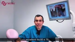 Neoss ProActive EDGE - Testimonianza del Dr. Giovannino Muci