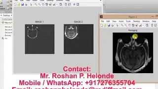 Matlab code for Image Fusion using Wavelet Transform