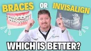 Invisalign versus Braces: Which is Right for You?