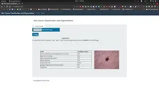 Skin cancer Detection Deep Learning Web App