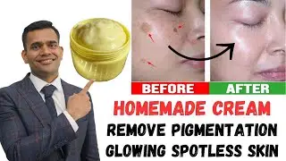 Remove Dark spots, Pigmentation And Get Younger Glowing Spotless Skin - Dr. Vivek Joshi