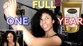 TAKING MSM FOR ONE WHOLE YEAR || My Conclusion
