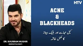 Acne and Blackheads Treatment by Dr. Khurram Mushir | Clinic Online | HTV